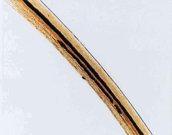 Somatic Origin (continued) Limb hairs (arm or leg) Fine diameter with little variation Arc-like, gross appearance Tips are usually tapered, often blunt and abraded, rounded scale ends due to