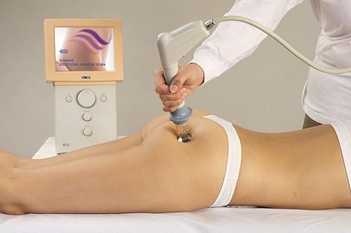 BODY TREATMENTS X-Wave Acoustic Wave Therapy What is X-Wave? - X-Wave is an advanced, scientifically proven cellulite treatment. How does it work?