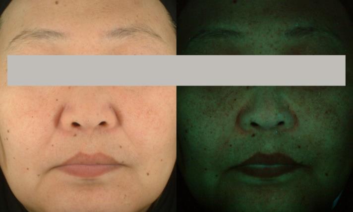 Technical Focus - TEGO Cosmo C250 Reduces melanin content 1.2 Increase in skin brightening (L*) relative to vehicle [%] Brighter appearance 0.9 0.