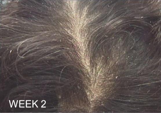Technical Focus - HairFlux Bio-inspired Ceramide Improves the
