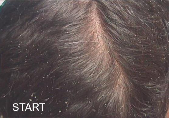 Outstanding repair efficacy on chemically treated hair INCI: Olea