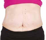 2 The results were achieved after using the ageloc Galvanic Body Spa and ageloc Body Shaping Gel three times a week, and the ageloc Dermatic Effects twice a day every day.