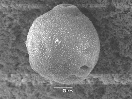 Microspheres with loaded B.