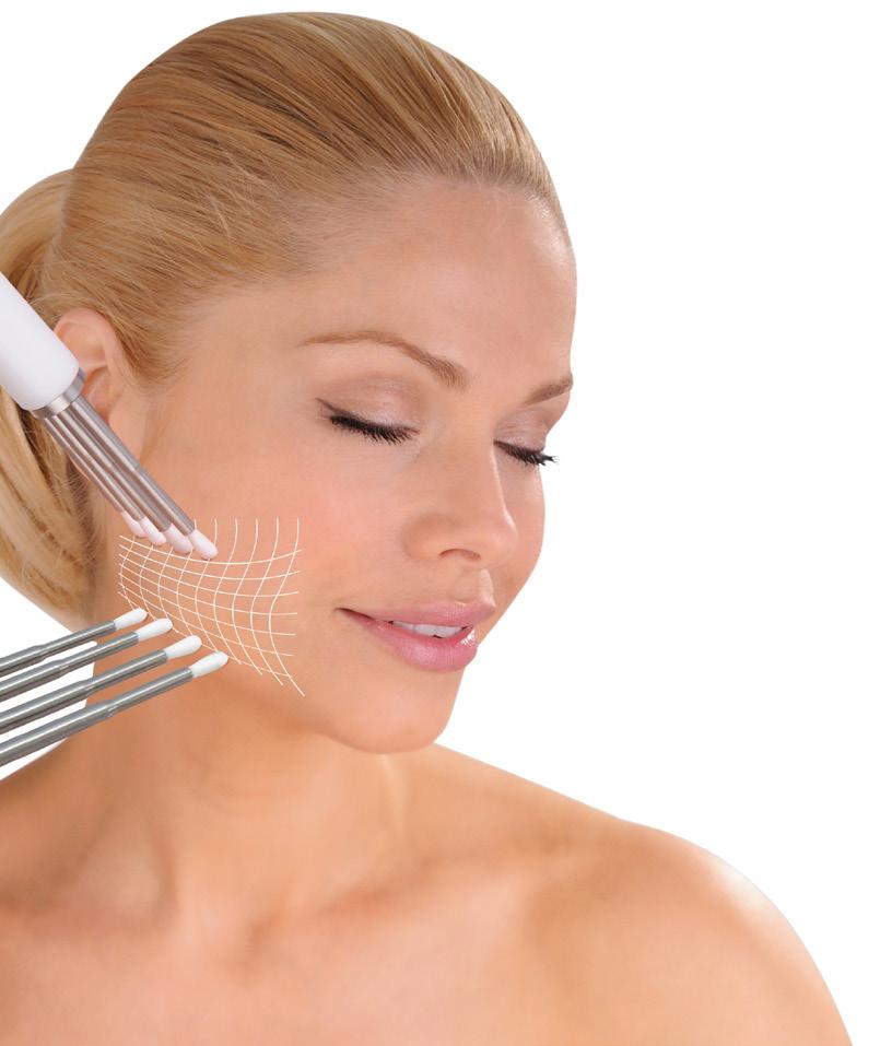 CACI Eye Revive (40 minutes) 35 Course of 10 (Buy 9 get 1 free) 315 Course of 15 (Buy 13 get 2 free) 455 The CACI Eye Revive treatment uses serum filled CACI micro-current rollers together with a