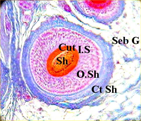 Wadad Z Moustafa et al Figure Computerized photomicrograph of transverse section in normal human scalp skin (Sh=hair shaft, Cut=Cuticle, IS=Inner sheath, OSh=Outer sheath, Ct Sh=