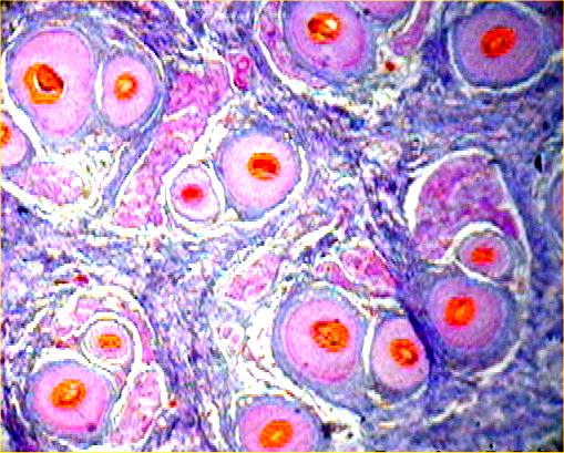 Quantitative Morphometric2 2 Figure Computerized photomicrograph of transverse section in normal