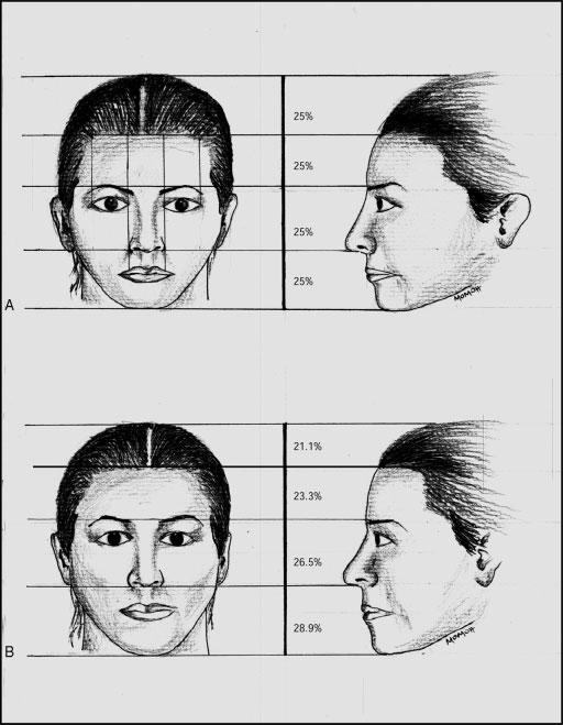 VARIATIONS OF STRUCTURAL COMPONENTS/McKNIGHT ET AL 165 Figure 1 (A) Frontal and lateral views of a young adult face based on neoclassic canons.