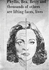 This drawing appeared in a newspaper. More than a face lift would be required to obtain the result depicted above.