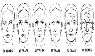 Liposuction can remove unwanted fat from the neck and jaw line.