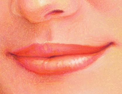 With some fillers, a slightly over-filled appearance may be initially present.