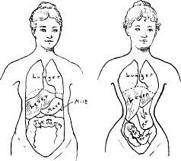 More about the Corset Severely damages the internal