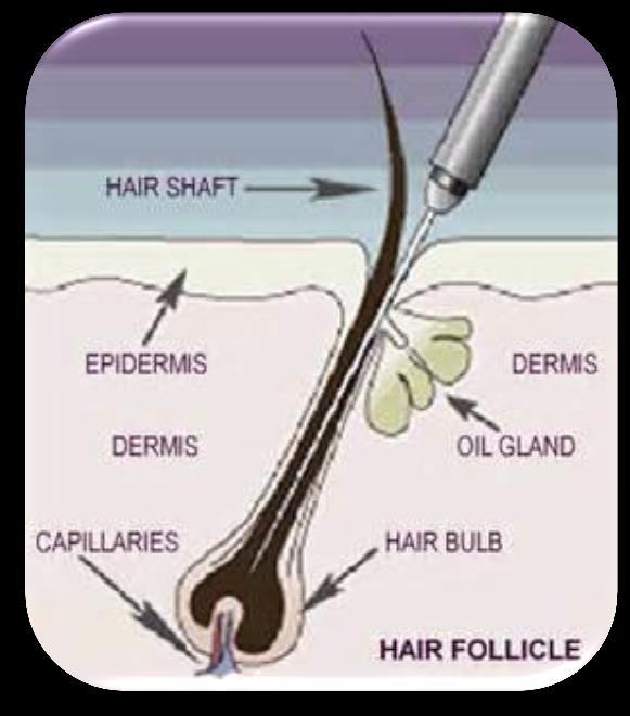What is Electrolysis? Electrolysis is a method of removing individual hairs from the face or body.