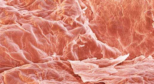 In association with: Figure 2: Coloured scanning electron micrograph of skin taken from a 2-week-old baby.