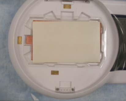 Assembling the iblot 2 Transfer Stack, continued 4. Place the Bottom Stack with the plastic tray directly on the blotting surface.