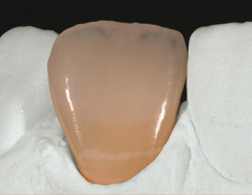 Shade application on the incisal area (adjustment of translucency) To intensify the translucency of the incisal area and to adjust the