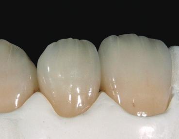 The frontal application of Paste Stains creates a stronger coloration.