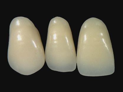 Basic shades with stains AS or BS Enamel effects with Blue White and Gray Cervical
