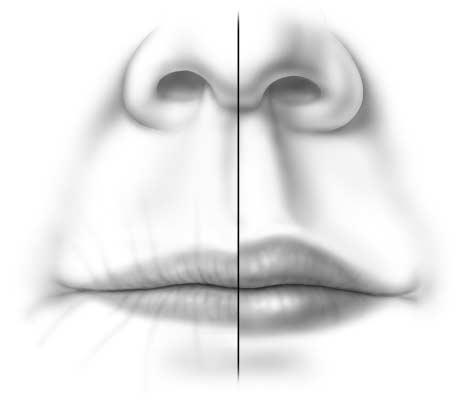 Figure 3. Aging (left) and youthful (right) lips.