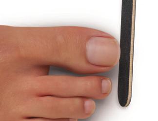If necessary, trim the length from each nail, using nail clippers. e. Shape the nail edge (tip of the nail) with a soft grit Kanga File or Koala Buffer.