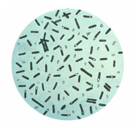 HOW IT WORKS Botulic Toxine Produced by bacteria (Clostridum botulinum) Mul8ple types of botulic toxins exist (A, B, C, D, E, F) Clostridum