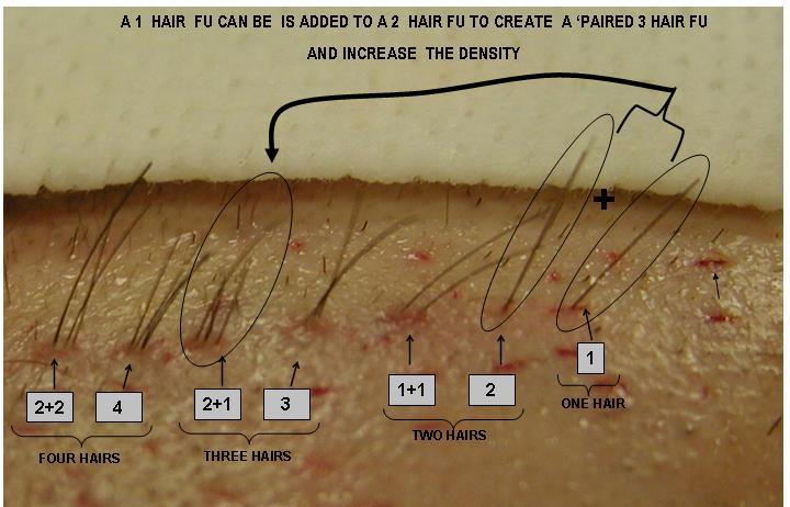 7 ROPER ANGLE, DIRECTION Angle and direction are distinct entities. Angle refers to the degree of elevation a hair as it exits the scalp.