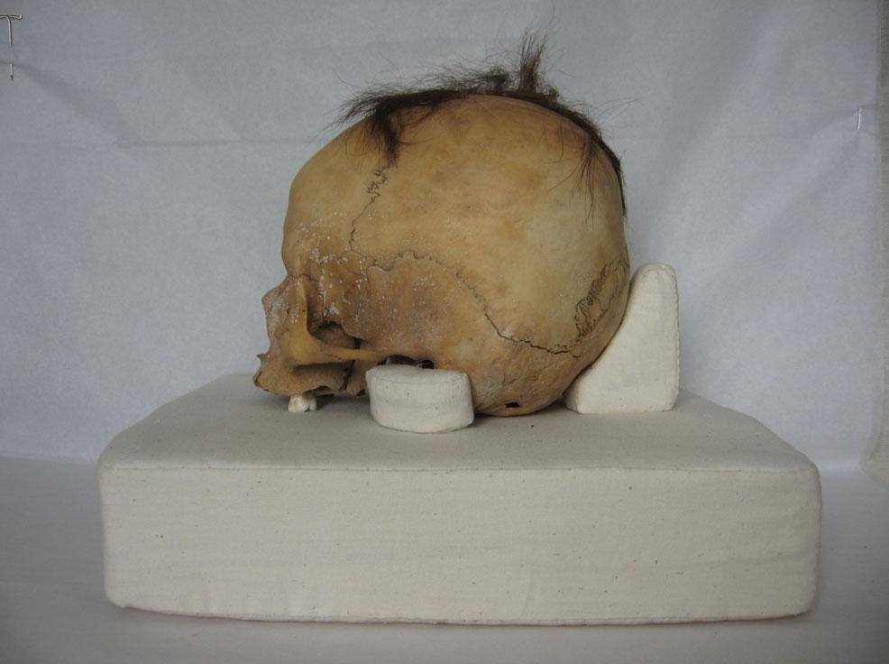 Skull after conservation-mounted Headdress after conservation with support net This is a human skull without lower jaw, wearing a headdress. Two molars remain in the upper jaw.