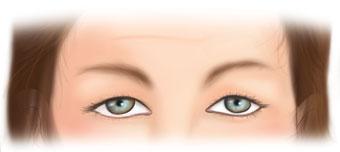 Forehead injections should be tailored or customized to the patient s forehead size and shape. In addition, one must take into consideration the placement of the eyebrow over the superior orbital rim.