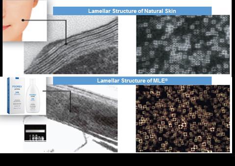 Skin lipid-identical lamellar structure Improves and reinforces the skin barrier Intensive and prolonged skin moisturization Skin Lipid Components Ceramide