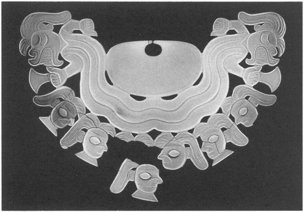 Wypyski) Figure 42. Radiograph of silver-and-gold nose ornament from Figure 31 (photo: author) character of this type ofjoin and to hypothesize how it was executed.