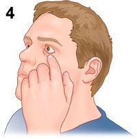 How to Use Eye Drops (Using a mirror or having someone else give you the eye drops may make this procedure easier.