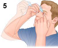 3 Avoid touching the dropper tip against your eye or anything else - eyedrops and droppers must be kept clean.