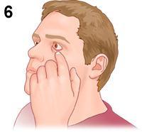 How to Use Eye Ointments and Gels (Using a mirror or having someone else give you the eyedrops may make this procedure easier.) 1Wash your hands thoroughly with soap and water.