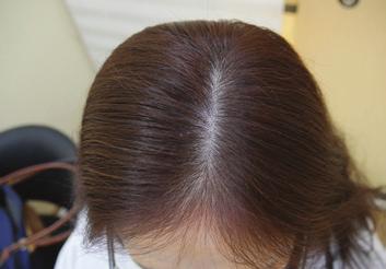 Experienced scalp soothing effects and other benefits in the scalp Q.
