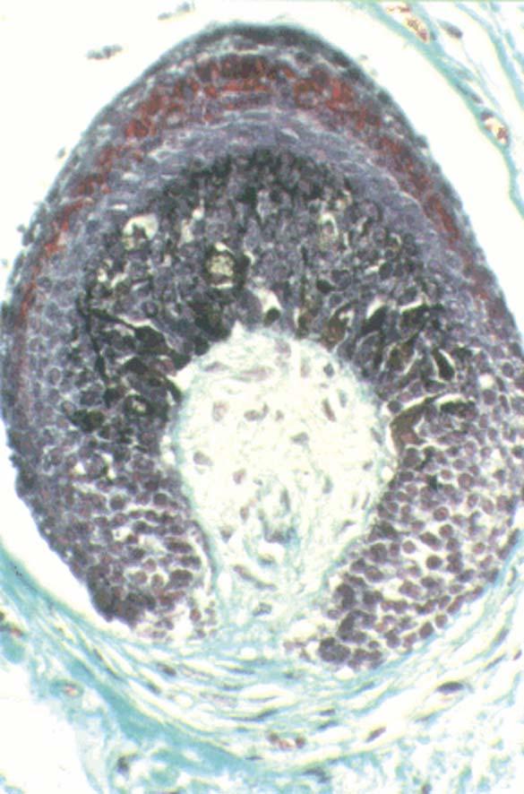 Hair follicle Bulb Papilla The hair follicle is the living part of the hair: - the bulb Made of cells, similar to basal