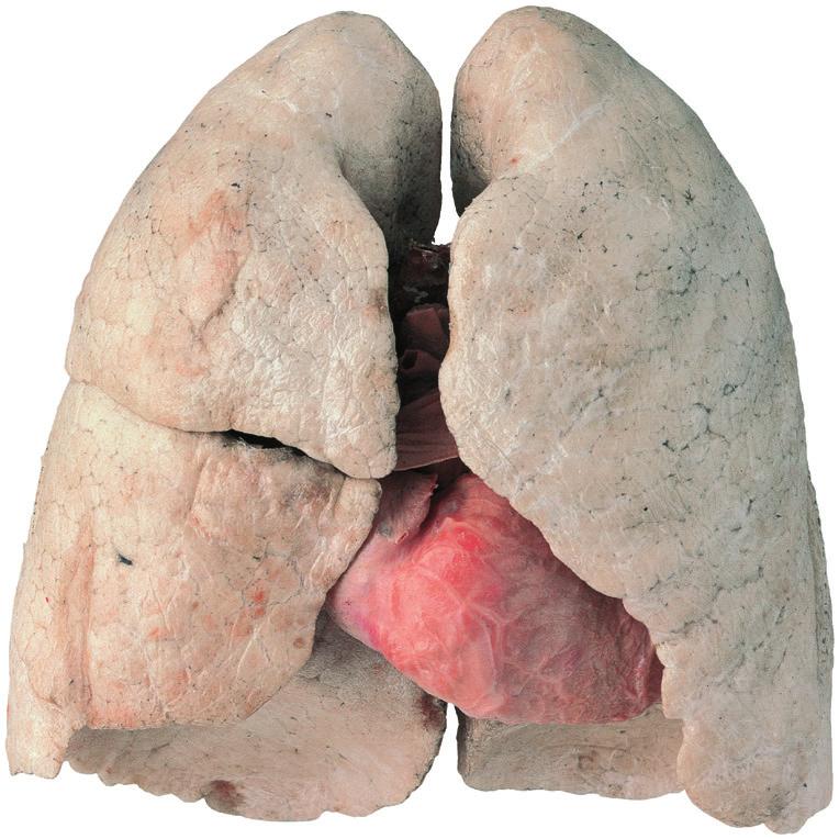 The Respiratory System Oxygen In, Carbon Dioxide Out Human life requires a continuous supply of oxygen which we extract from the air.