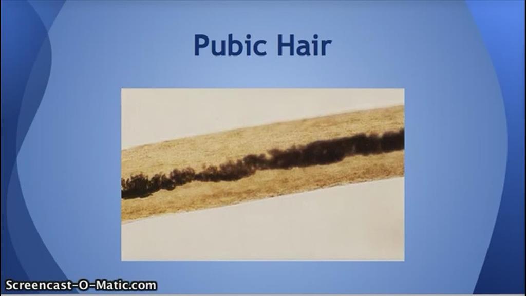 Pubic Hairs One of the kinds of evidence