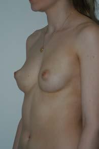 surgical cosmetic procedures available Gallery / Before