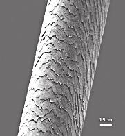 Scanning Electron Microscopy Study of human hair structure and specificity.