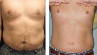 The secret is out! We ve got the latest in non-invasive, body slimming and tightening procedures for you! At Dr.