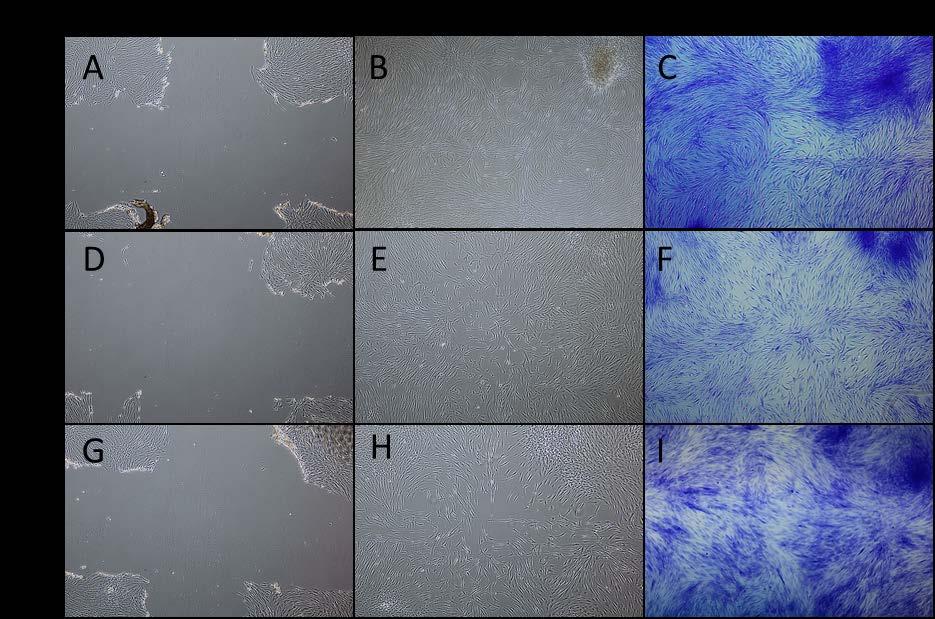 AC MOISTURE-PLEX Scratch Assay Analysis Human dermal fibroblasts were allowed to grow to confluency in complete DMEM 1.