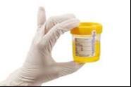collected when the participant first wakes in the morning NHMRC National Health and Medical Research Council Mid-stream urine sample - a urine specimen collected during the middle of a flow of urine,