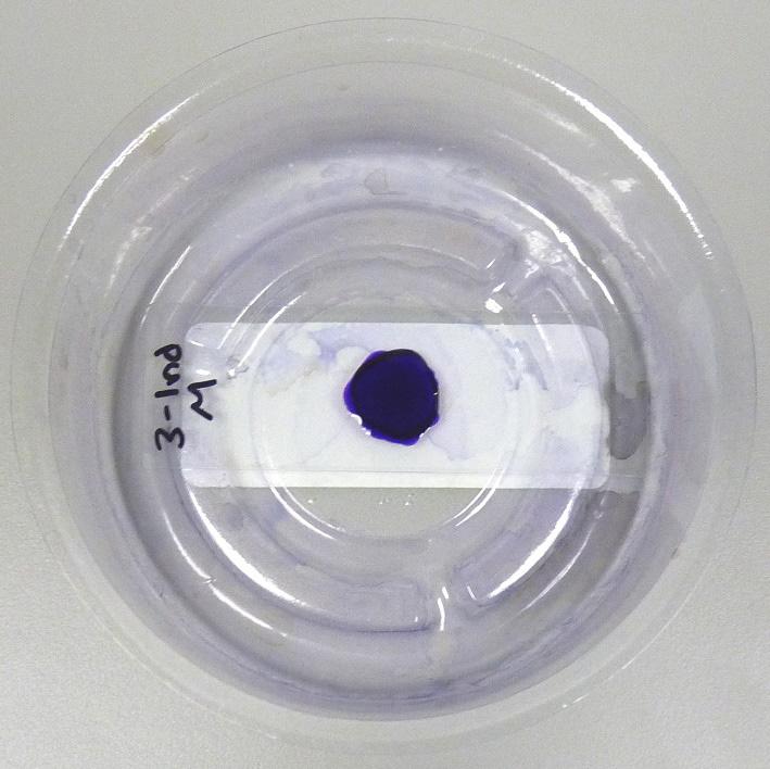 Figure 14. Applying Crystal Violet stain. 13.