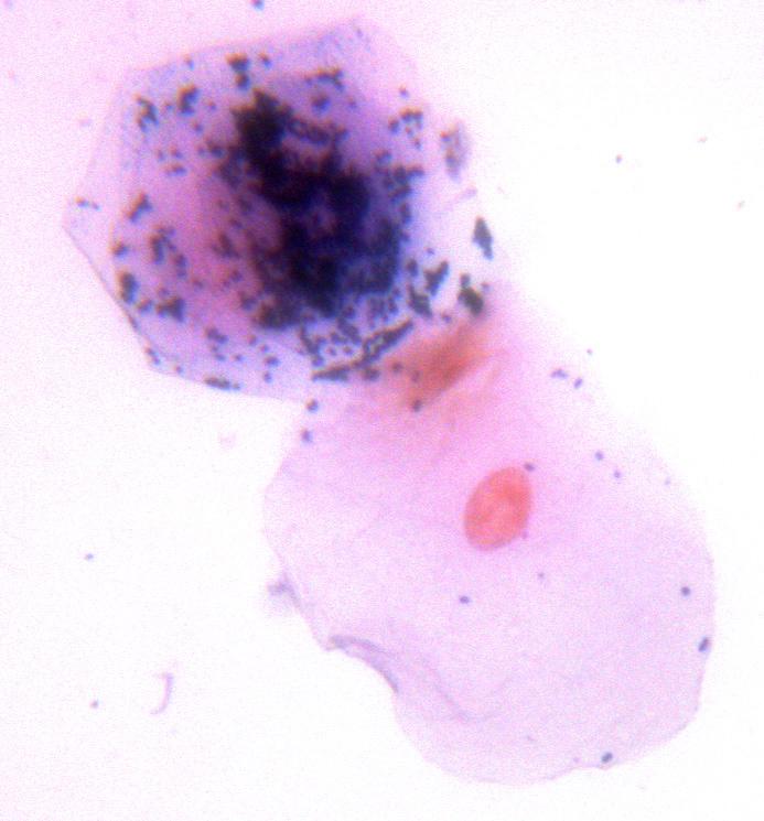 Figure 5. Gram stained bacteria (purple) and human cheek cells (pink). The Staining Process Stains are salts dissolved in a liquid and are composed of positive (+) and negative (-) ions.