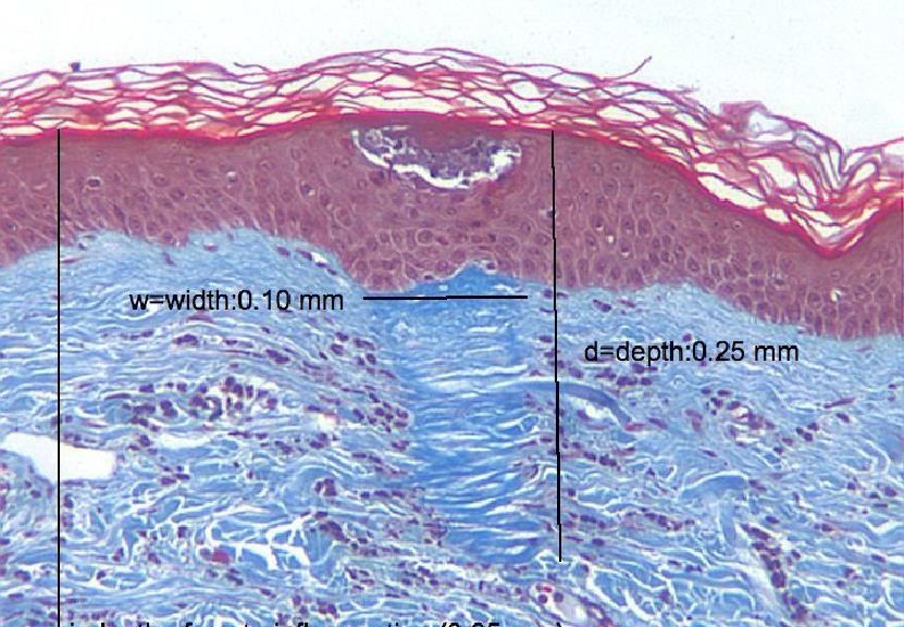 Dermal Tissue Histology E. Tanghetti, MD / R.