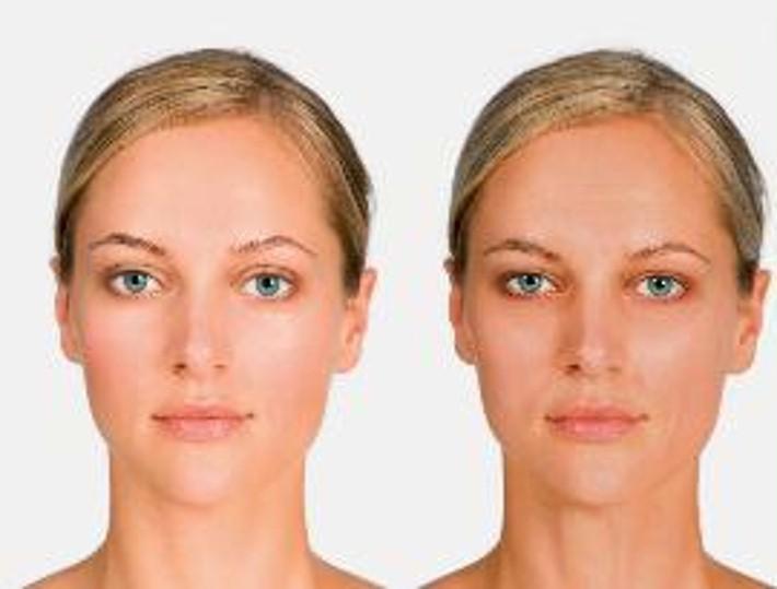 Seite - 5 - UV radiation accelerates skin ageing, which becomes evident in the form of external marks such as the appearance wrinkles and age marks.
