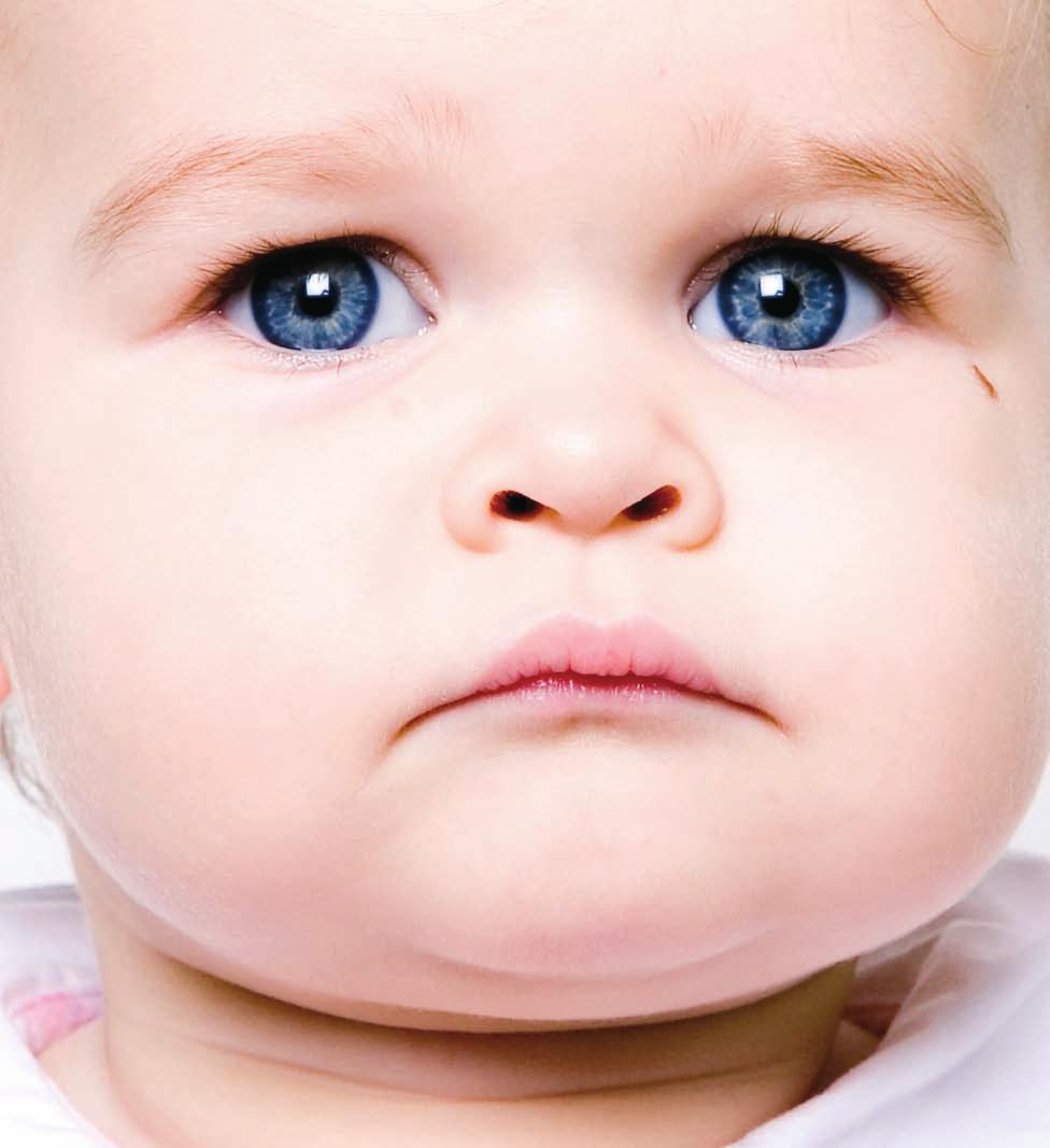 12 MINOR PROBLEMS DESPITE THE BEST DAILY CARE, YOUR BABY S SKIN MAY SUFFER FROM LOCA- LISED IRRITATION OR DRYNESS.