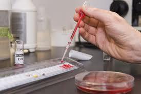 MICROBIOLOGY Challenge test Total viable count Detection and Identification: