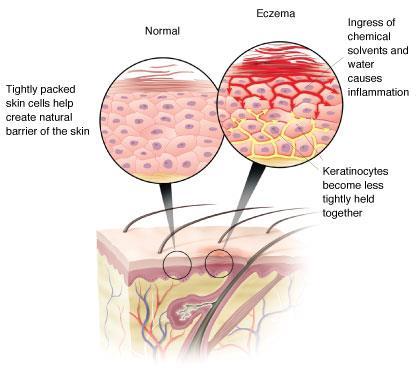 Functions of the Integumentary System 1.