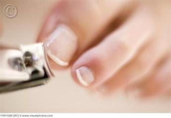 Toe nails should be properly trimmed to avoid discomfort