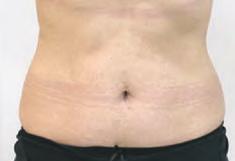 encurve fills a very real need because a lot of patients are looking for noninvasive treatments to address body shape, size and weight.
